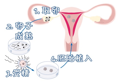 主案例